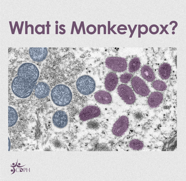 The Monkeypox Epidemic